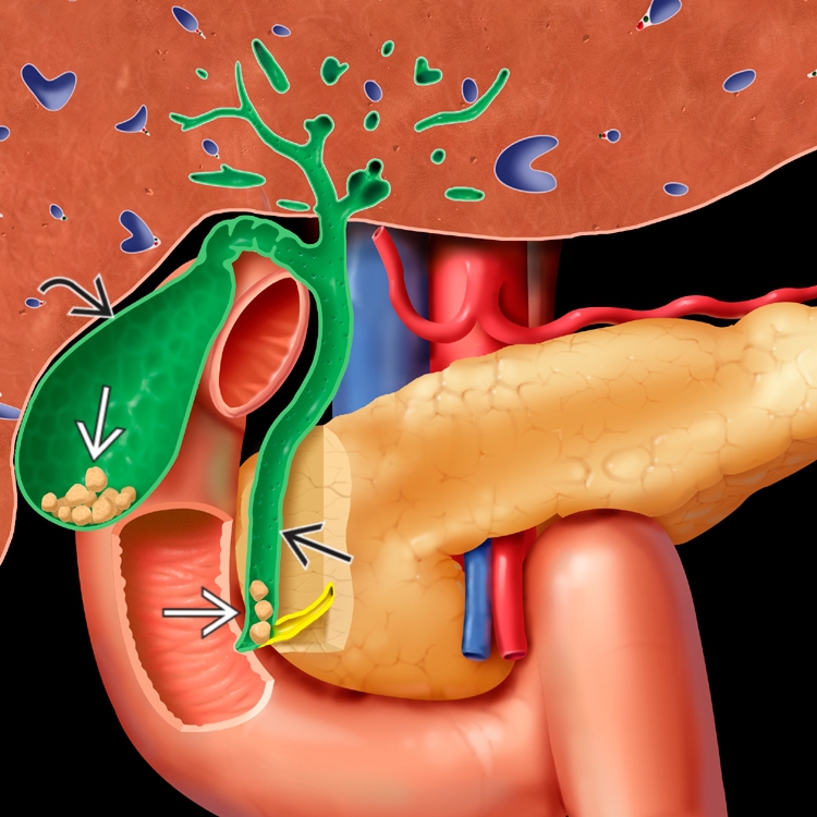 Lung Infection treatment in East Delhi