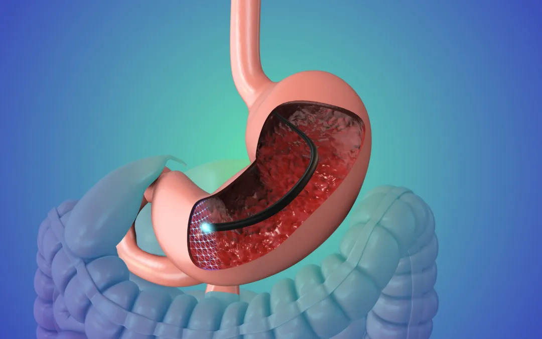 Best Endoscopy Centre in Dwarka, Delhi