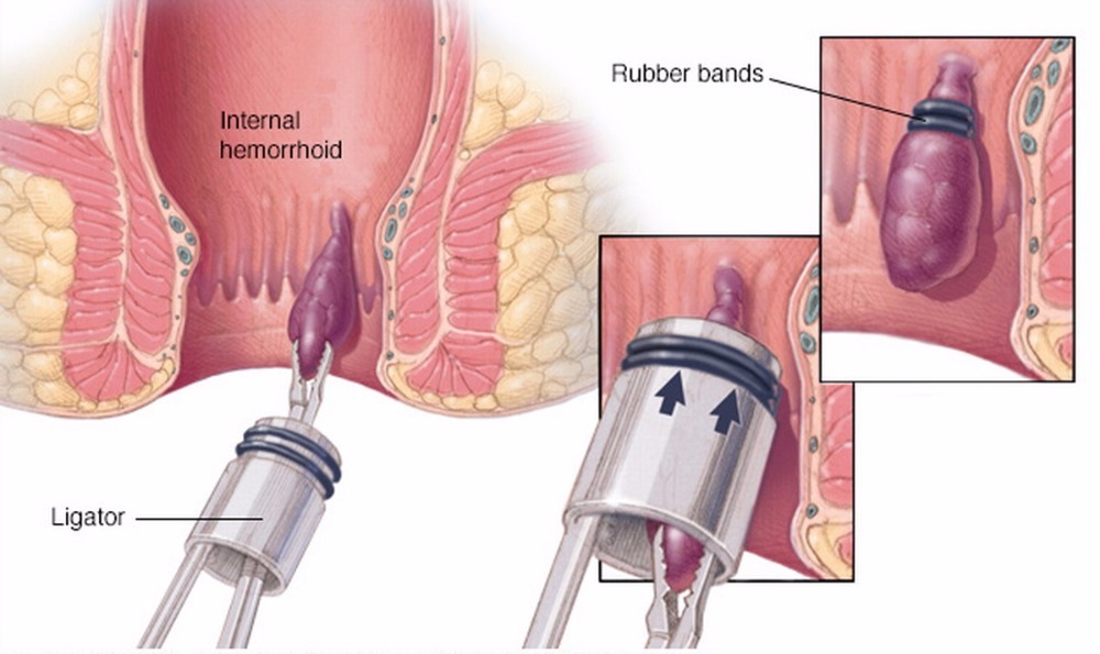 Best Endoscopy Services in Dwarka